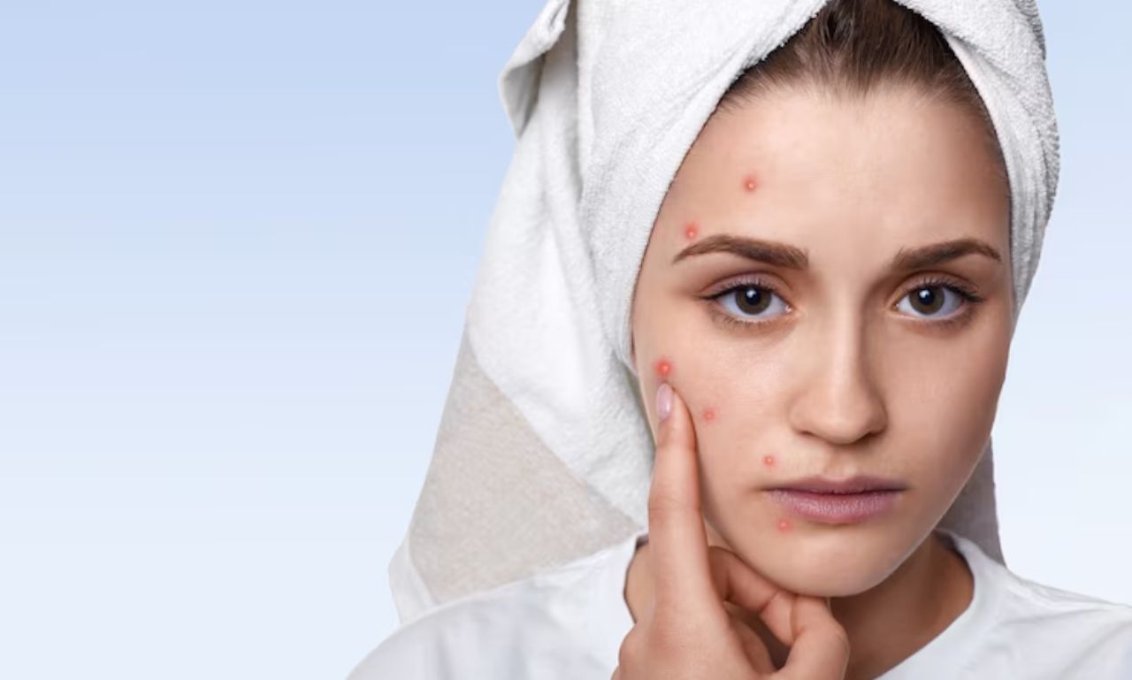skinpresT